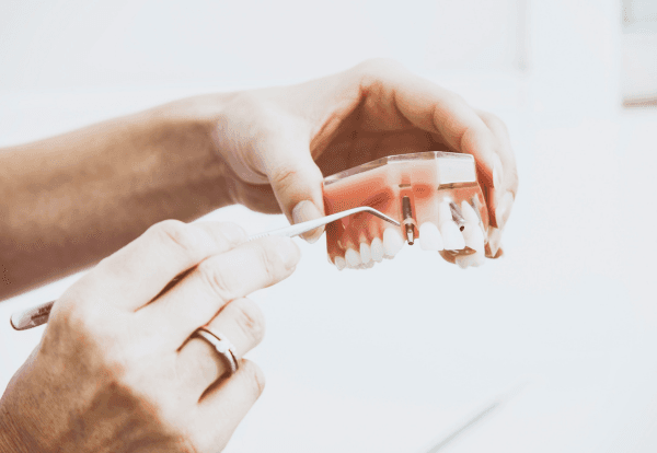 Implantología y periodoncia imagen