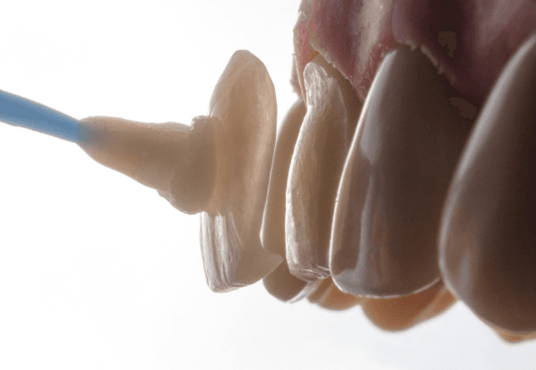 Rehabilitación oral imagen